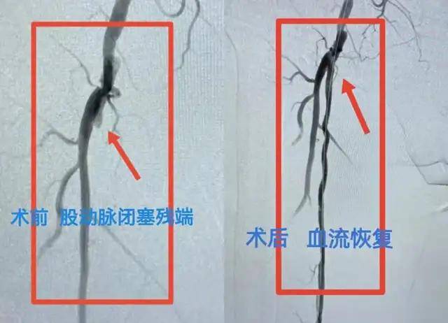 西安交通大学附一医院地址_西安交通大学第一附属医院_西安交通大学第一附属医院简介
